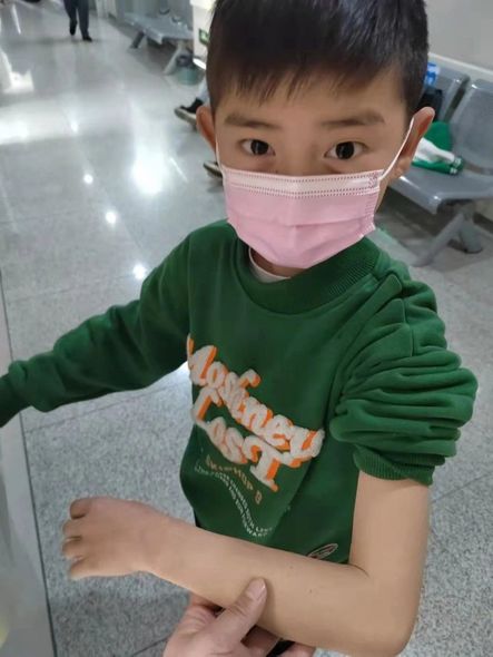 10 yaşlı cəsur uşaq anasının xilası üçün transplantasiya əməliyyatı oldu - FOTO/VİDEO