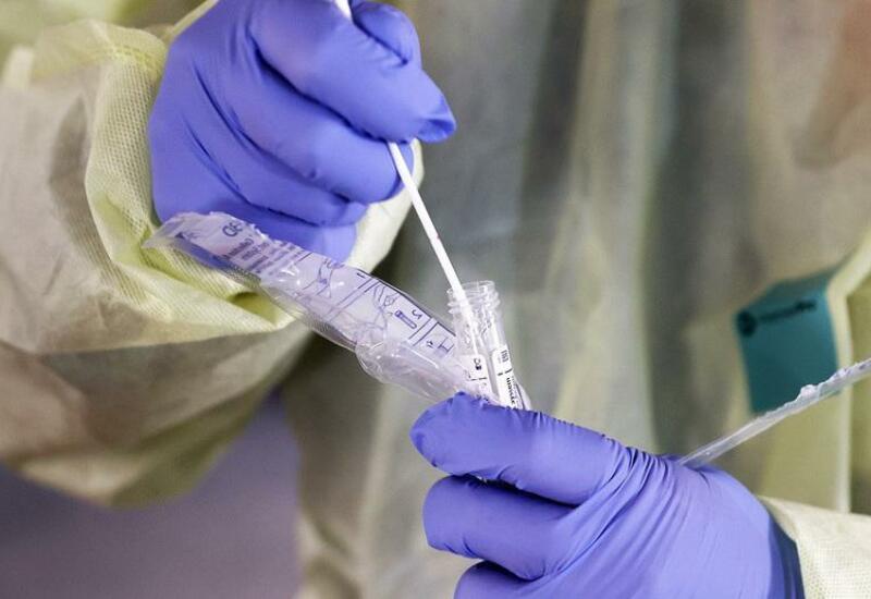 Sudanda meymunçiçəyi virusuna ilk yoluxma halı təsdiqlənib