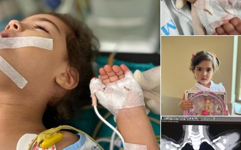 Bakıda 2 yaşlı körpə bir il nəfəs borusunda sümük parçası ilə yaşayıb - FOTO