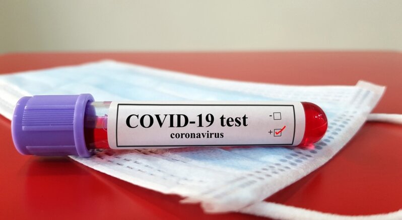 Azərbaycanda son sutkada 155 nəfər koronavirusa yoluxub, 1 nəfər ölüb