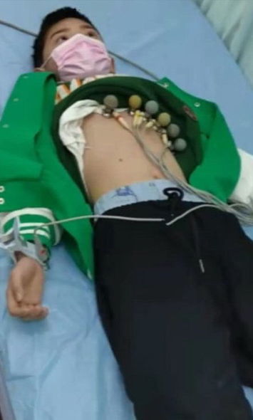 10 yaşlı cəsur uşaq anasının xilası üçün transplantasiya əməliyyatı oldu - FOTO/VİDEO