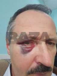 Rusiyada qohumu xəstəxanada öldüyü üçün ermənilər HƏKİMLƏRİ DÖYDÜLƏR - FOTO/VİDEO