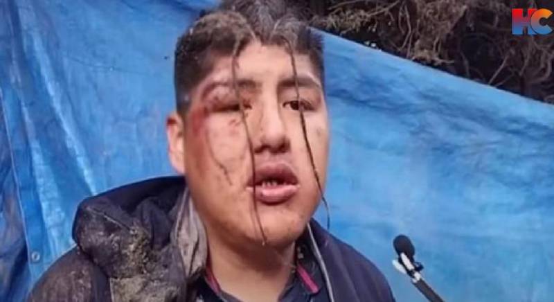 İçib huşunu itirən şəxsi diri-diri torpağa basdırdılar - FOTO + VİDEO